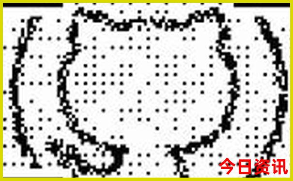镜泊湖门票包含哪些景点